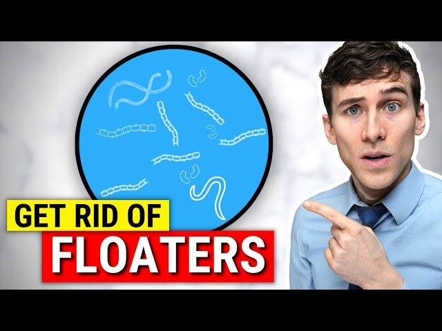 How to Get Rid of Eye Floaters - Eye Floaters Treatment Explained