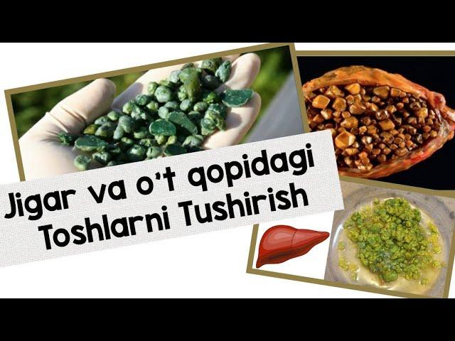 Ajoyib JIGAR va O'T QOPIDAGI toshlarni Tushirish.Epsom tuzi 3 stakan suvga 4 osh qoshiq.