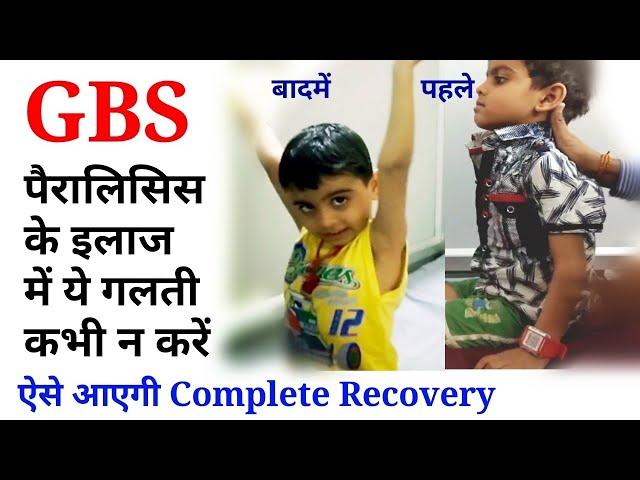 gbs physiotherapy treatment || paralysis exercise for hand and leg || guillain barre syndrome.