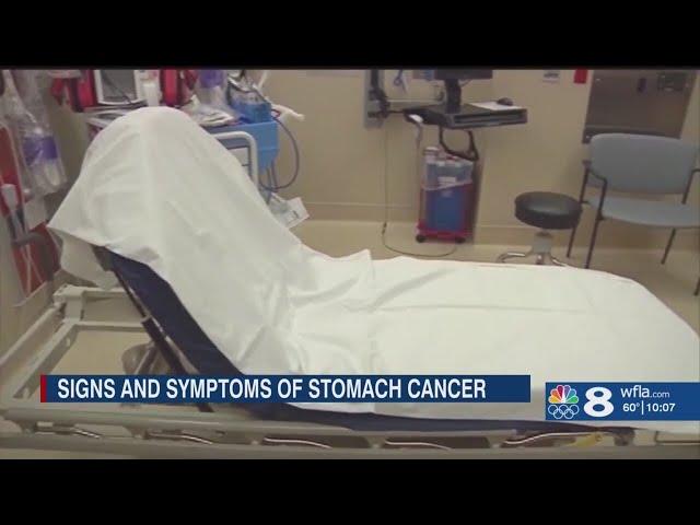 GI experts warn of stomach cancer symptoms and preventative measures you can take