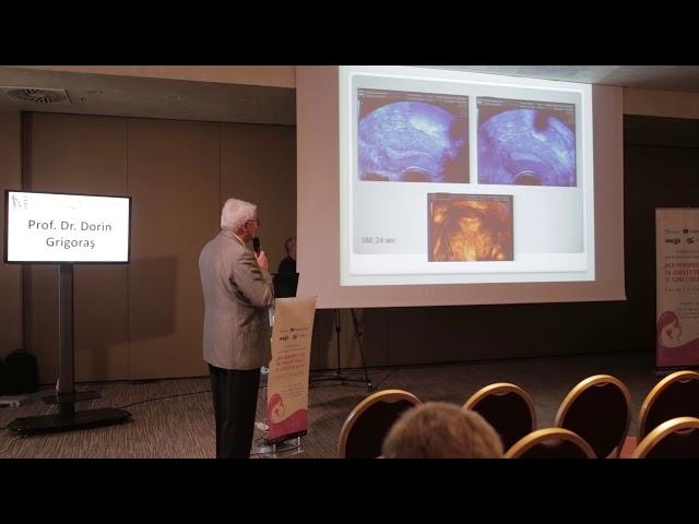 Prof. Dr. Dorin Grigoras - adenomioza si bolile asociate