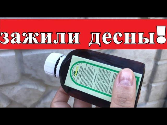 МОЩНЫЙ ЭФФЕКТ! Зажили ДЕСНЫ, И ПАРОДОНТОЗ  Исчез!