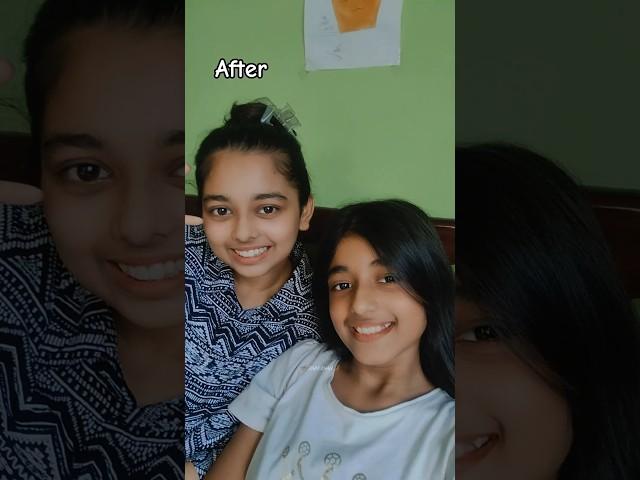 Rida and Roha before vs after#subscribe#trend#sisters#shorts