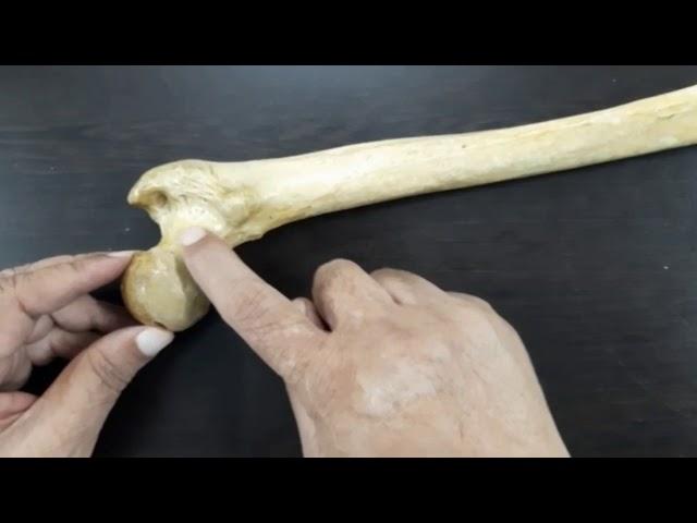 7. Femur-I