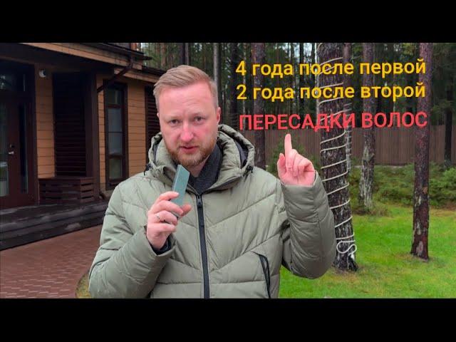 4 года после первой и 2 года после второй пересадки волос.