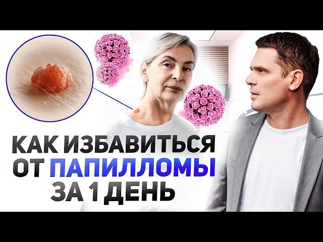 Папилломы и Бородавки. Как ЗА 1 ДЕНЬ Избавиться От Них НАВСЕГДА?