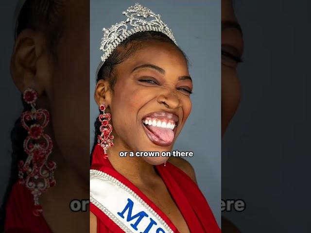 Veneers vs Crowns #shorts #crowns #dentalcare #teeth #veneers #cincinnati