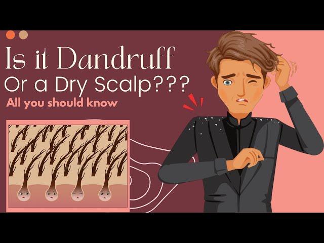 Is It Dandruff Or A Dry Scalp? Here's What You Need To Know