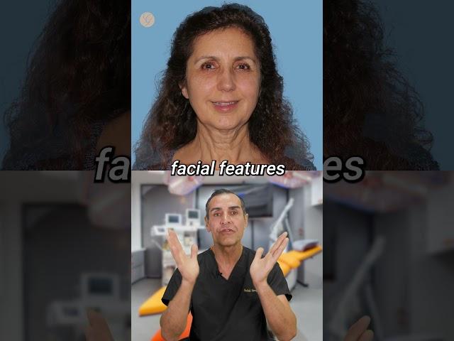 Facial Rejuvenation Case Study #antiaging #cosmetic #plasticsurgeon #casestudy #face #beforeandafter
