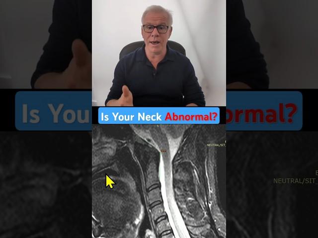 What is a Clivo-axial Angle or CXA?