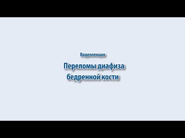 Переломы диафиза бедренной кости