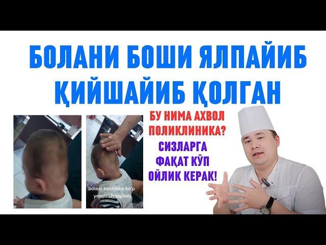 ТАРҚАГАН ВИДЕО БОЛАНИ БОШИ БЕШИК САБАБ ҚИЙШАЙГАН ДЕДИ БУНГА ИСЧАНОВ АСЛ САБАБЛАРНИ ОШКОР ҚИЛИБ БЕРДИ