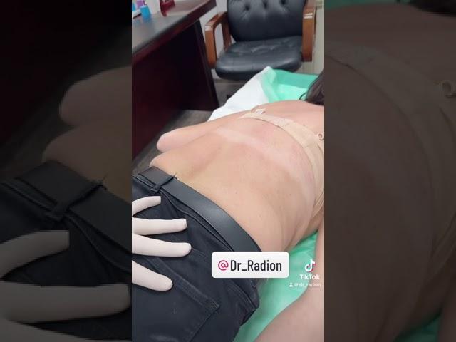 Spine treatment with back pain from Dr. Radion