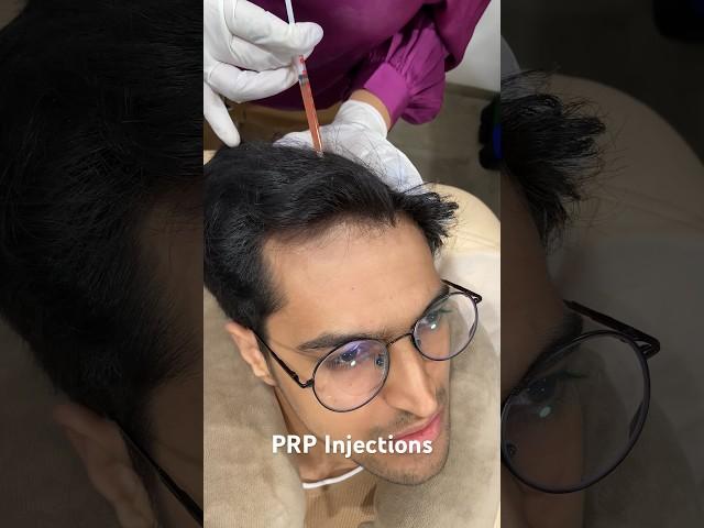 PRP Treatment For Hair loss | Best Hair Regrowth Treatment For Men #prptreatment