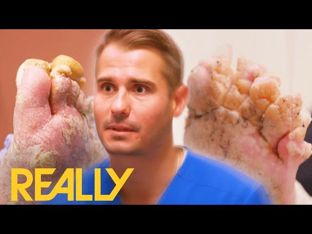 Most SHOCKING Foot Conditions Ever! | My Feet Are Killing Me