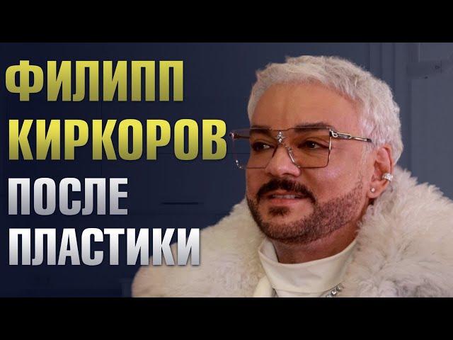 Какие пластические операции сделал Филипп Киркоров? Киркоров До и После пластики