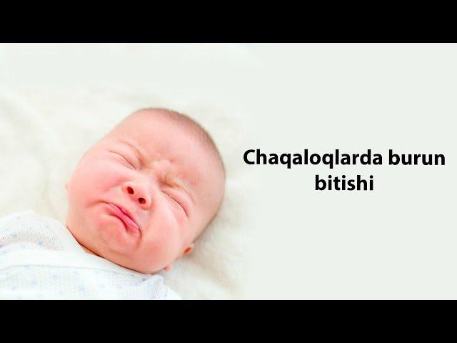CHAQALOQLARDA BURUN BITISHI