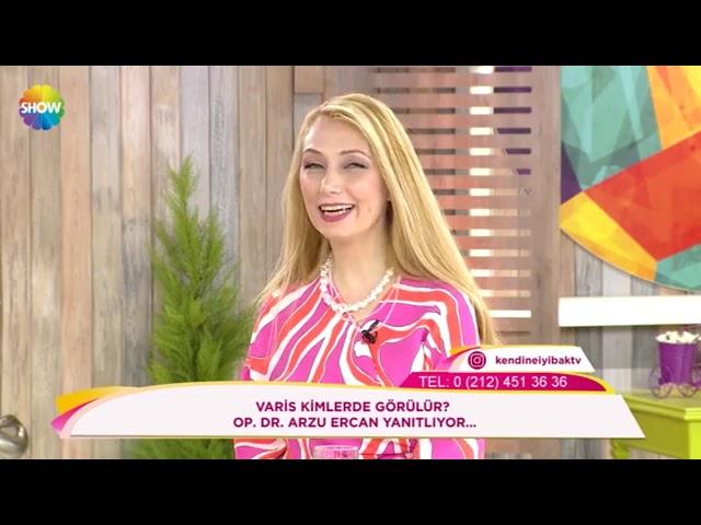 Varis hakkında tüm bilinmeyenler . Op.Dr.Arzu Ercan Anlatıyor .