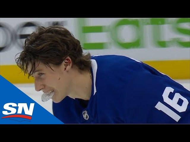 Jacob Trouba Hits Mitch Marner In The Ear With Puck