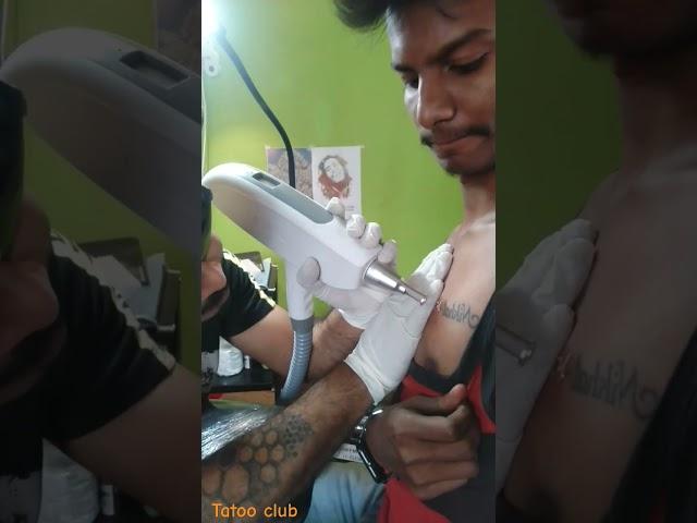 Chest Tattoo Remove| Permanent Tattoo Remove Centre| Laser Treatment|#tattoo #viral #laser #remove