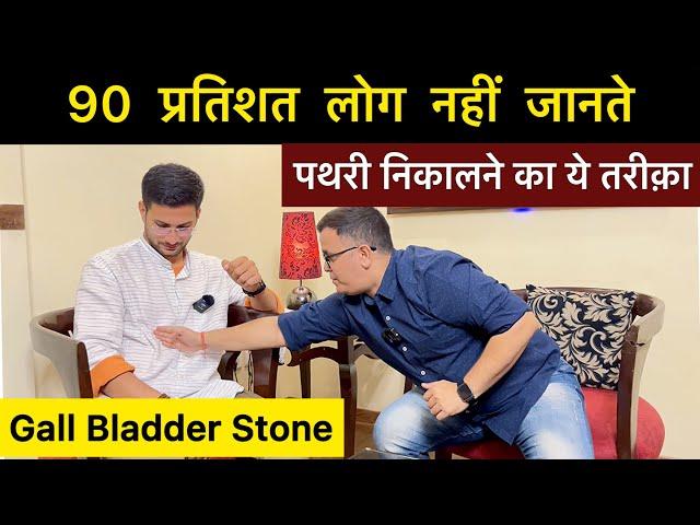 Pathri ka ilaj | Gall bladder stone treatment at home | Homeopathy | Himanshu Bhatt