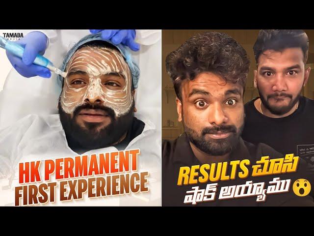 HK Permanent First Experience | Result చూసి Shock అయ్యాము | Rj Chaitu | Rj Chaitu Vlogs