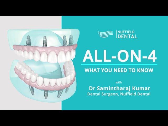 What is All-On-4? with Dr Samintharaj Kumar, Dental Surgeon, Nuffield Dental