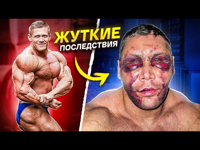 КАЧОК ИСПОРТИЛ СЕБЕ ЛИЦО / последствия фейслифтинга