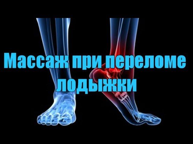 Массаж при переломе лодыжки. Массажист Андрей Илюшкин.