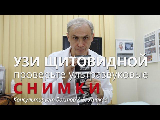 УЗИ щитовидной железы: Снимки, Стоимость (цена) Снимков УЗИ, Какие снимки УЗИ... || Доктор Ушаков