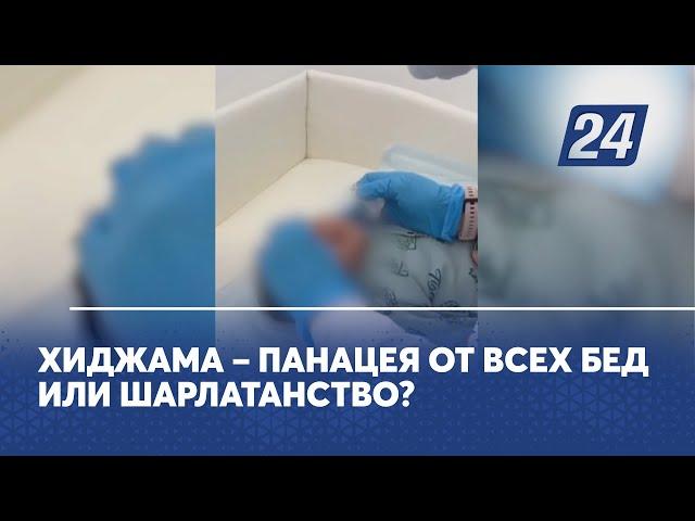 Хиджама – панацея от всех бед или шарлатанство?