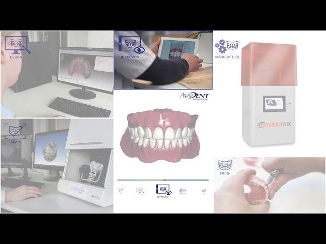 Dental 3D Printing and Software Leaders Join Forces