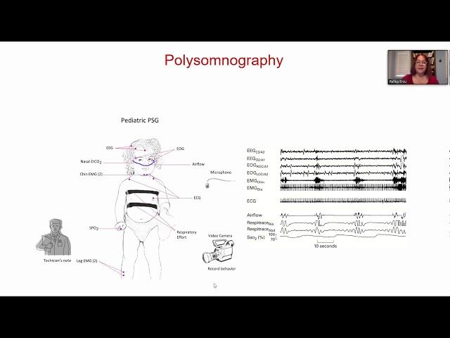 Polysomnography by Dr Refika Ersu