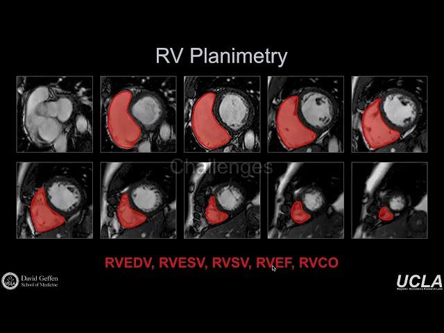 ISMRM MR Academy -Functional Analysis