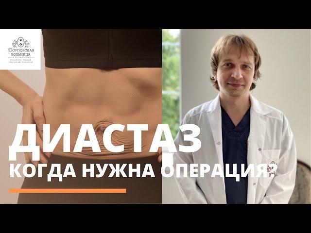 Диастаз: когда нужна операция?