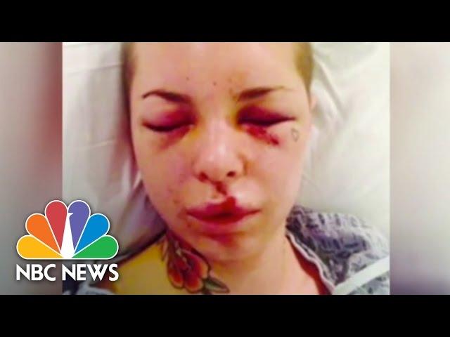 Christy Mack Assaulted By MMA's 'War Machine' | NBC News