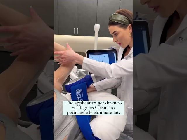 CoolSculpting Elite at The Skin Center