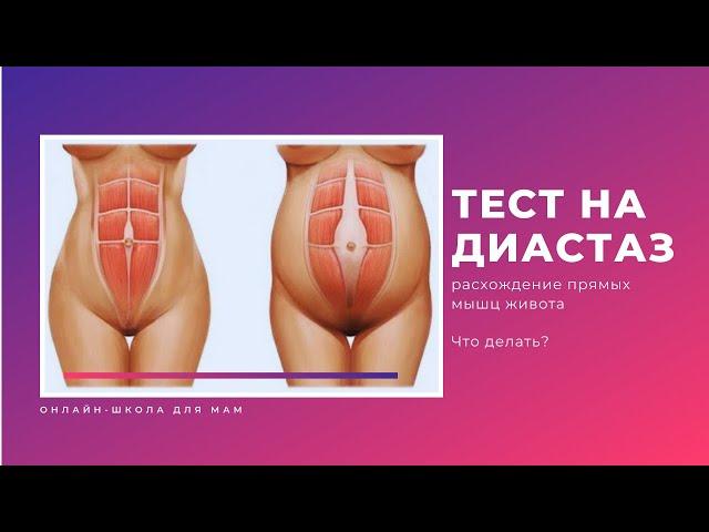 Тест на ДИАСТАЗ (расхождение) прямых мышц живота | КАК ОПРЕДЕЛИТЬ диастаз после родов | Диагностика