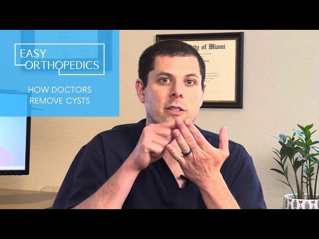 How doctors remove cysts