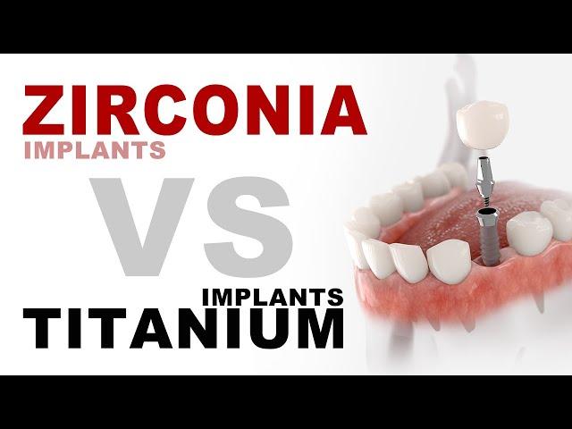 Zirconia Implants VS Titanium Implants | Aria Dental | Maryam Horiyat DDS.