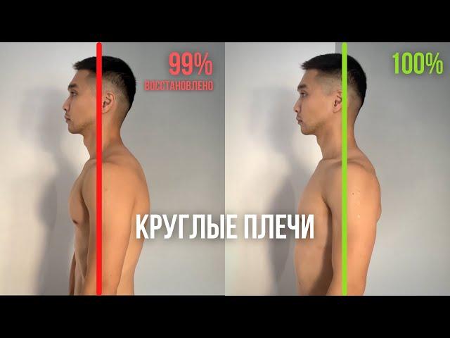 Как исправить КРУГЛЫЕ ПЛЕЧИ (Последствия кифоза грудного отдела)