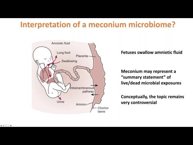 IAFNS: The Mycobiome with Dr. Joe F. Pierre