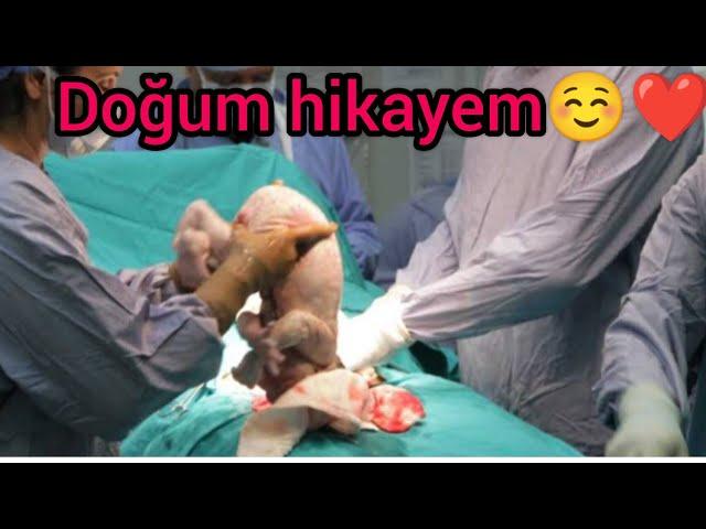 RÜZGAR URAS 'IN DOĞUM HİKAYESİ OLAYSIZ Bİ DOĞUMUM YOK @İKİPAŞABİRPRENS