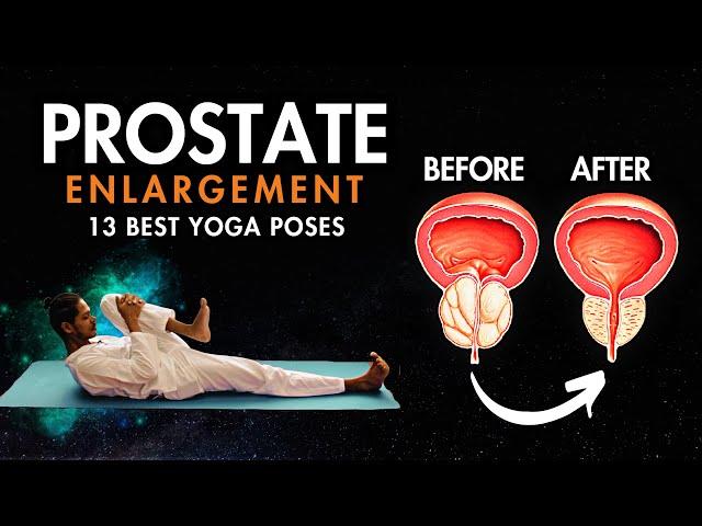 Yoga for Prostate Problems | 13 Best Prostate Yoga Exercises #prostatecancer