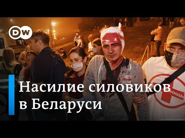 Насилие силовиков в Беларуси. Без комментариев