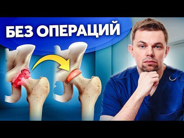 Пошаговый план лечения суставов! Лучшие способы БЕЗ ОПЕРАЦИИ