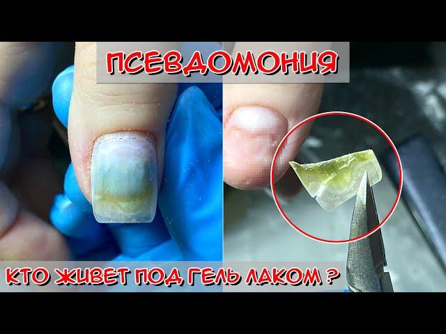 Green nail under gel  / Pseudomonia on nails