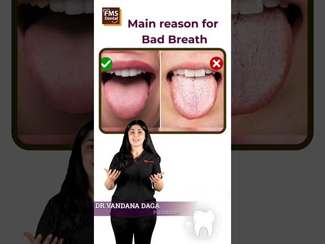 Reasons for bad breath | Bad Breath Treatment | Halitosis Treatment | FMS Dental