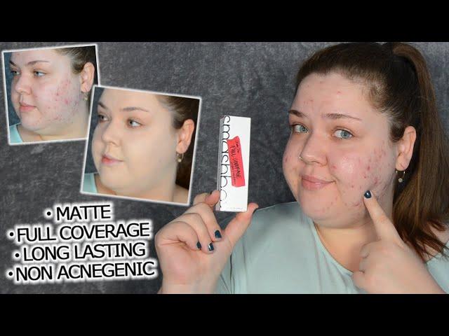 SMASHBOX STUDIO SKIN FULL COVERAGE 24HR FOUNDATION TESTED ON  OILY, ACNE PRONE SKIN