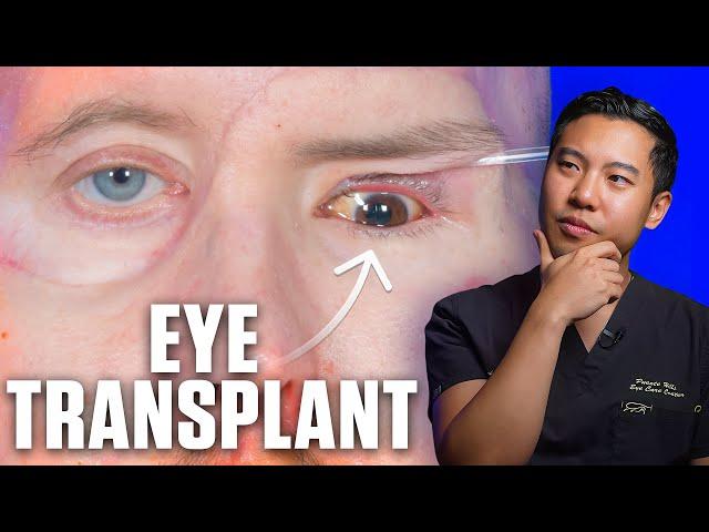 This man received the world's FIRST eye transplant, but CAN HE SEE?